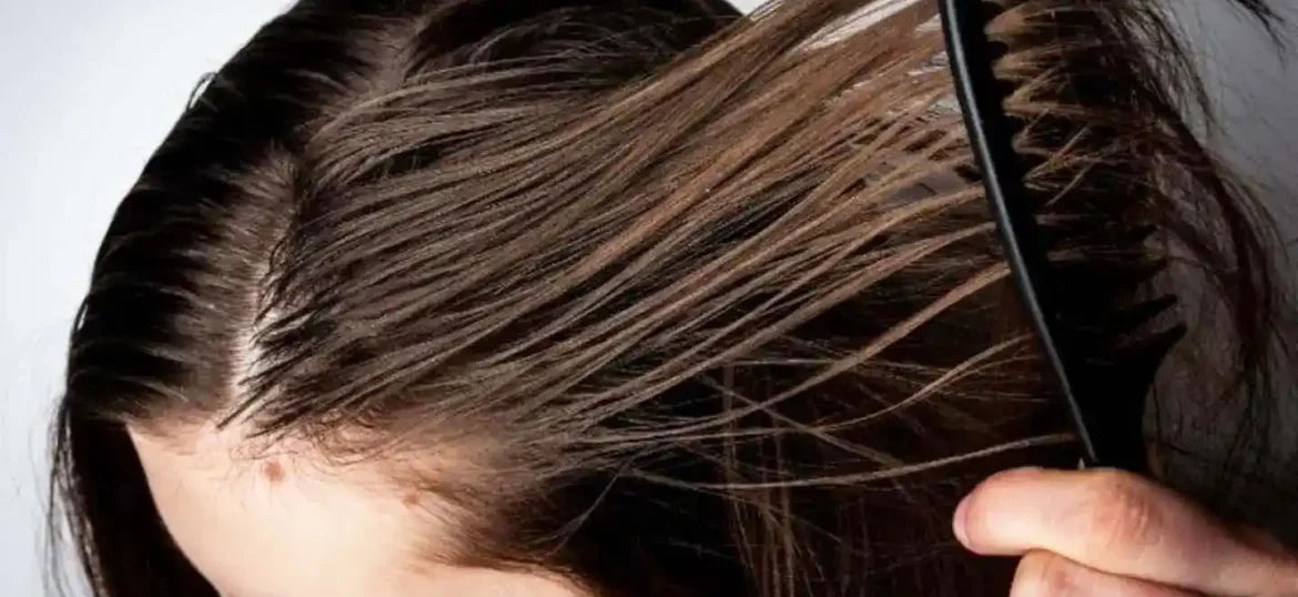 The Ultimate Guide to Oily Scalp : Best shampoo For Oily Hair