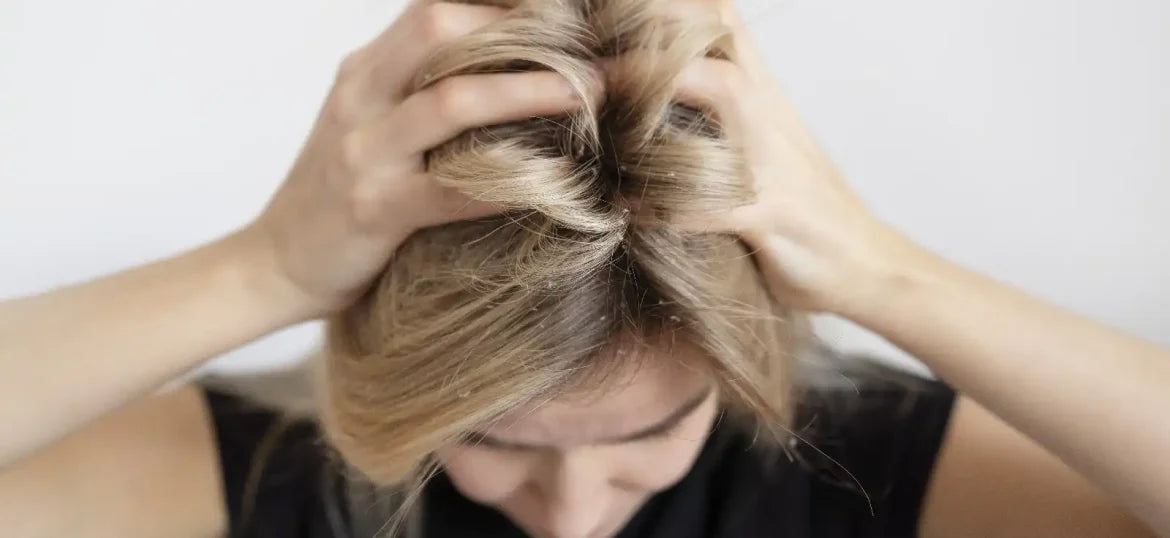 Dry Scalp vs. Dandruff: Understanding the Differences