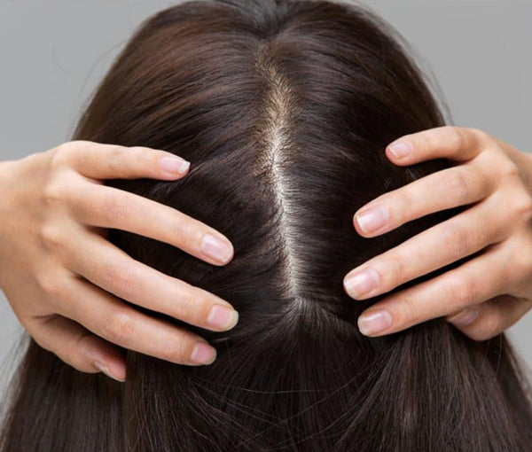 Scalp Care Is Fundamental