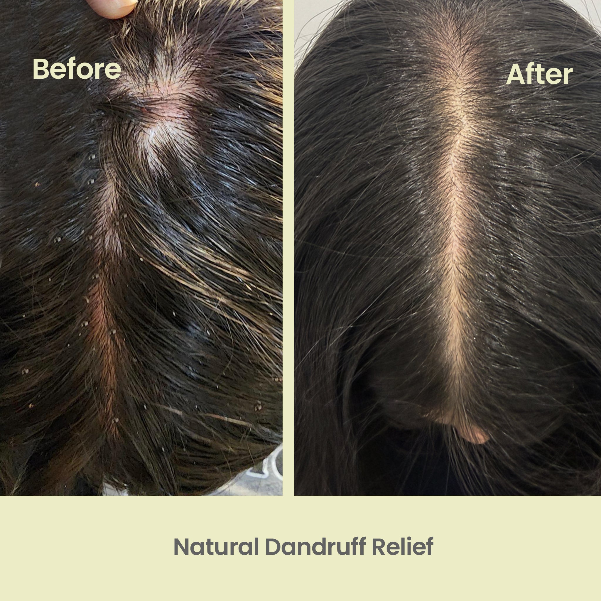 Tea Tree Shampoo