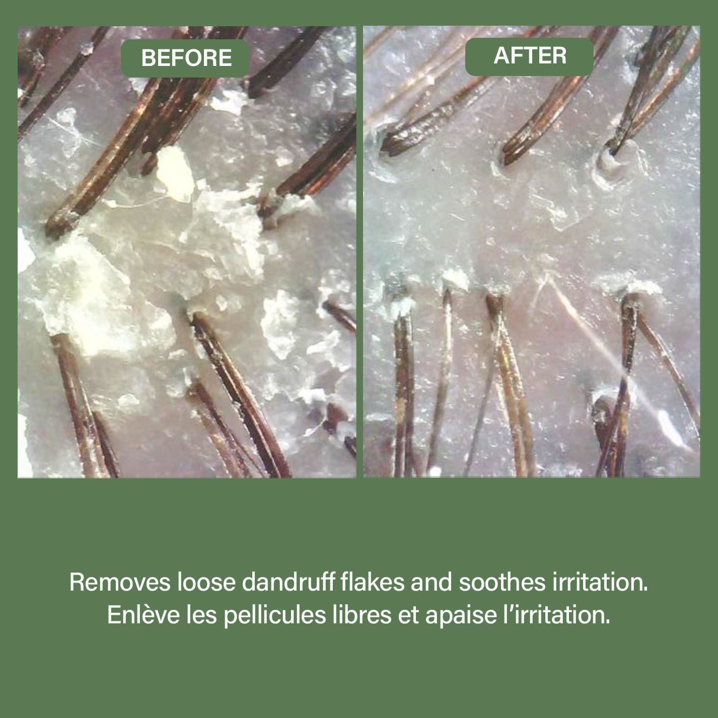 Tea Tree Shampoo